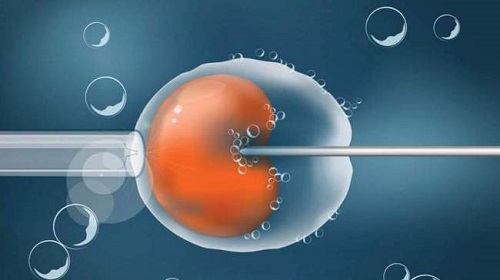 试管囊胚等级怎么区分？怎样提高试管成功率？